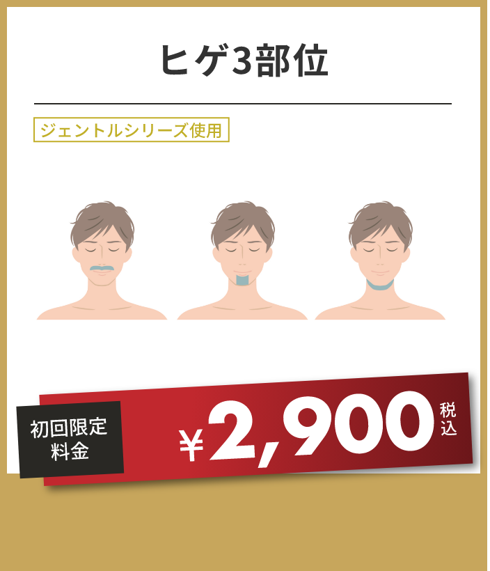 ヒゲ3部位