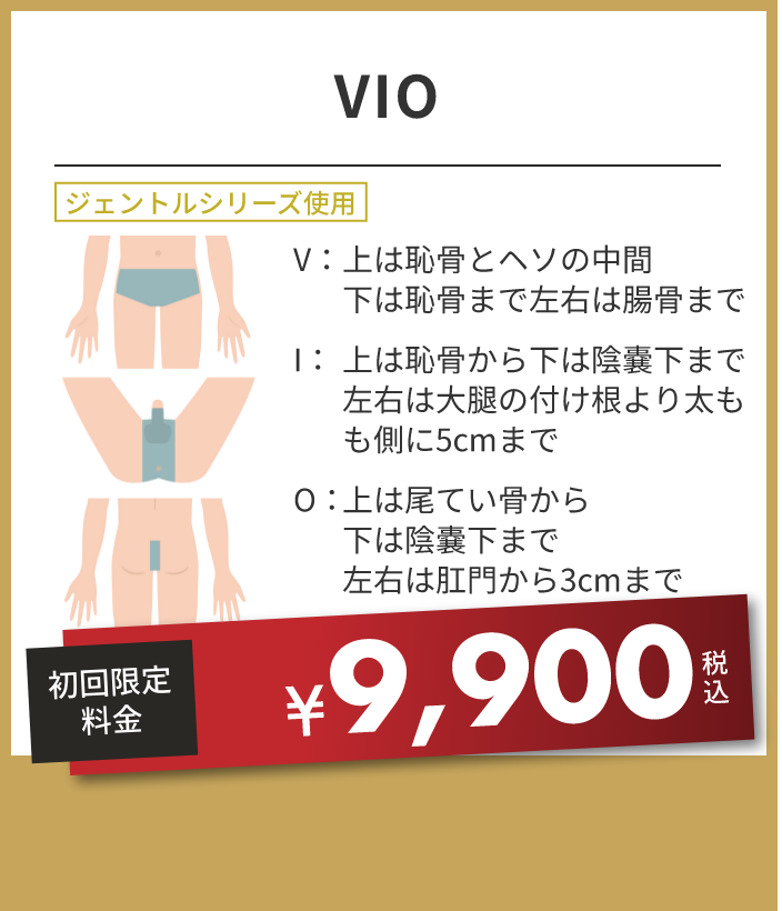 VIO